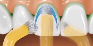 The Areas Of Use And Correct Use Of A Single Tufted Tooth Brush